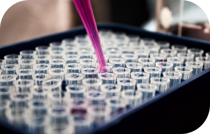 in-licensing Pipette and test tubes